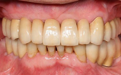 After image