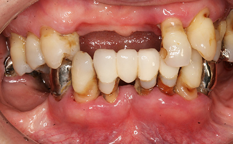 Before image