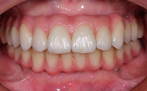 After image