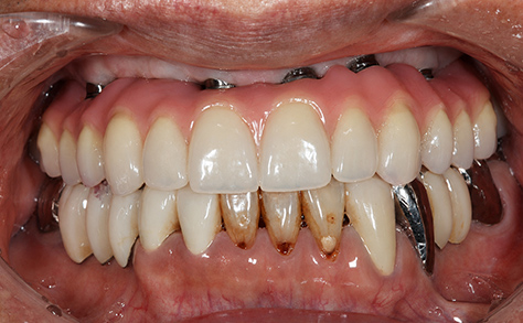 After image
