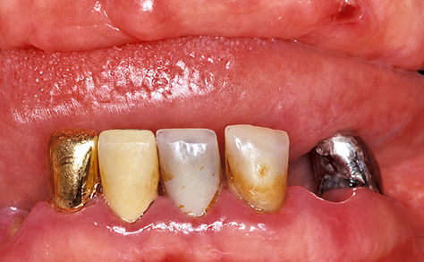 Before image
