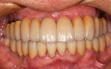 After image