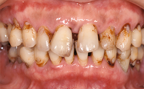 Before image