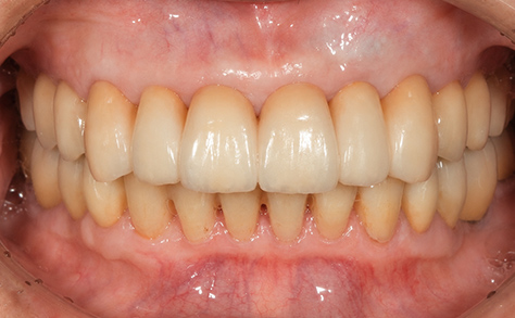 After image