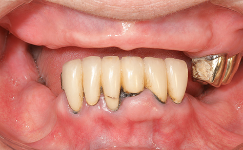 Before image