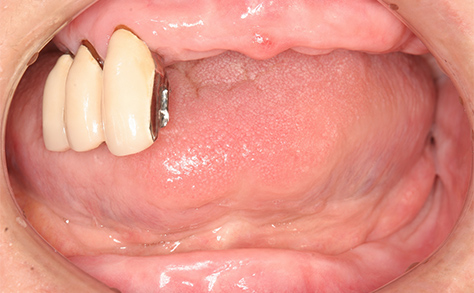 Before image