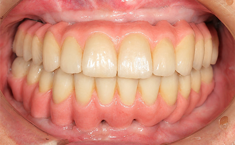 After image