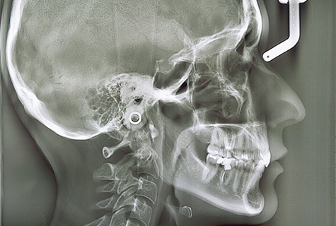 東京大森の歯医者・矯正歯科「大森沢田通り歯科・予防クリニック」｜セファロ