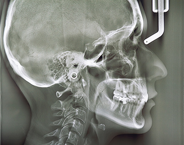 東京大森の歯医者・矯正歯科「大森沢田通り歯科・予防クリニック」｜セファロ