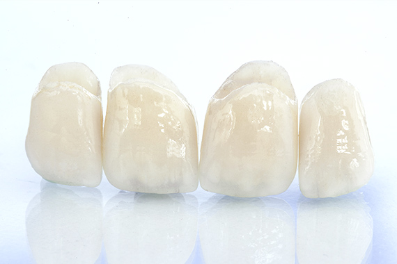 東京大森の歯医者・矯正歯科「大森沢田通り歯科・予防クリニック」｜セラミック