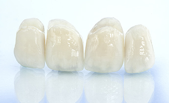 東京大森の歯医者・矯正歯科「大森沢田通り歯科・予防クリニック」｜セラミック