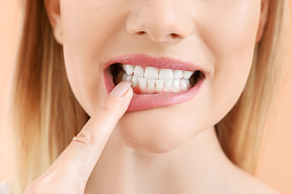 東京大森の歯医者・矯正歯科「大森沢田通り歯科・予防クリニック」｜口内炎