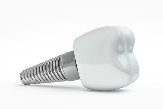 東京大森の歯医者・矯正歯科「大森沢田通り歯科・予防クリニック」｜保証制度