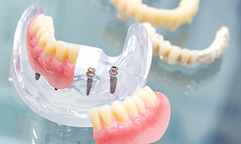 東京大森の歯医者・矯正歯科「大森沢田通り歯科・予防クリニック」｜オールオン4