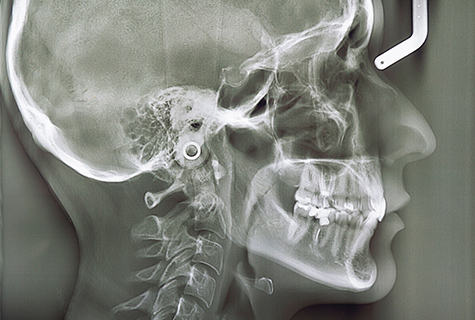 東京大森の歯医者・矯正歯科「大森沢田通り歯科・予防クリニック」｜セファロ