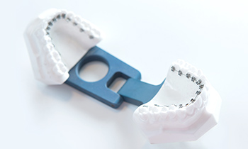 東京大森の歯医者・矯正歯科「大森沢田通り歯科・予防クリニック」｜リンガル矯正