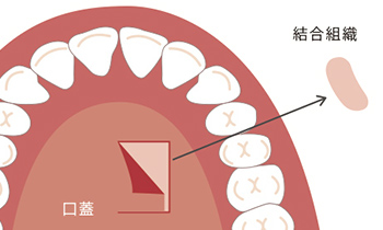 東京大森の歯医者・矯正歯科「大森沢田通り歯科・予防クリニック」｜CTG