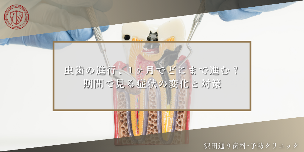 虫歯の進行、1ヶ月でどこまで進む？期間で見る症状の変化と対策