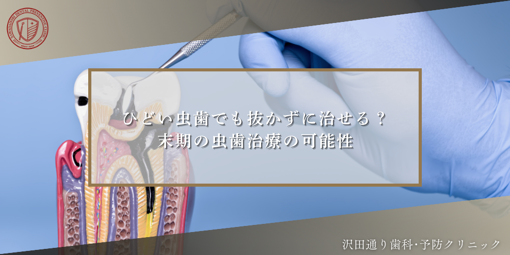 ひどい虫歯でも抜かずに治せる？末期の虫歯治療の可能性