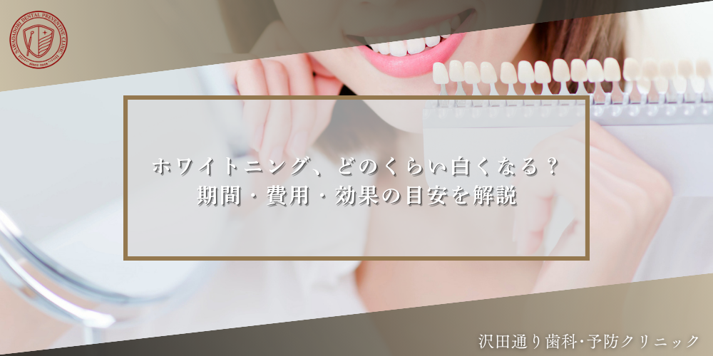 ホワイトニング、どのくらい白くなる？期間・費用・効果の目安を解説