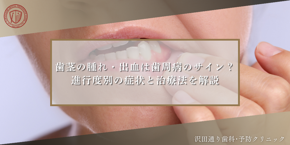 歯茎の腫れ・出血は歯周病のサイン？進行度別の症状と治療法を解説